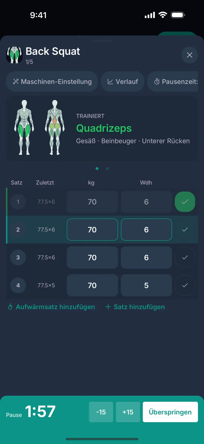 Der Pausen-Timer läuft nach einem gespeicherten Satz, mit -15 s, +15 s und Überspringen.